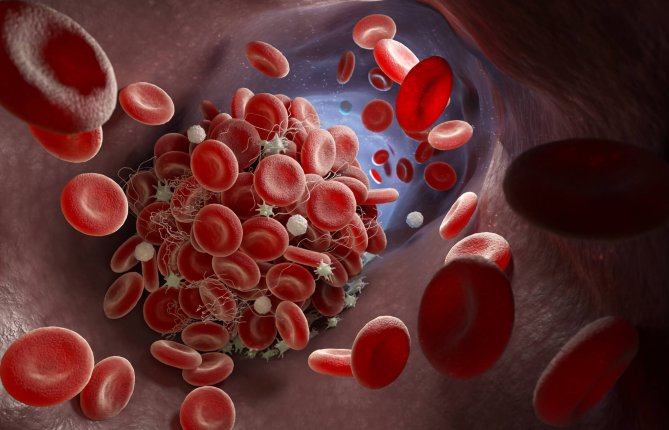 Du système immunitaire aux vaisseaux sanguins: comment limiter les thromboses lors d’infections sévères