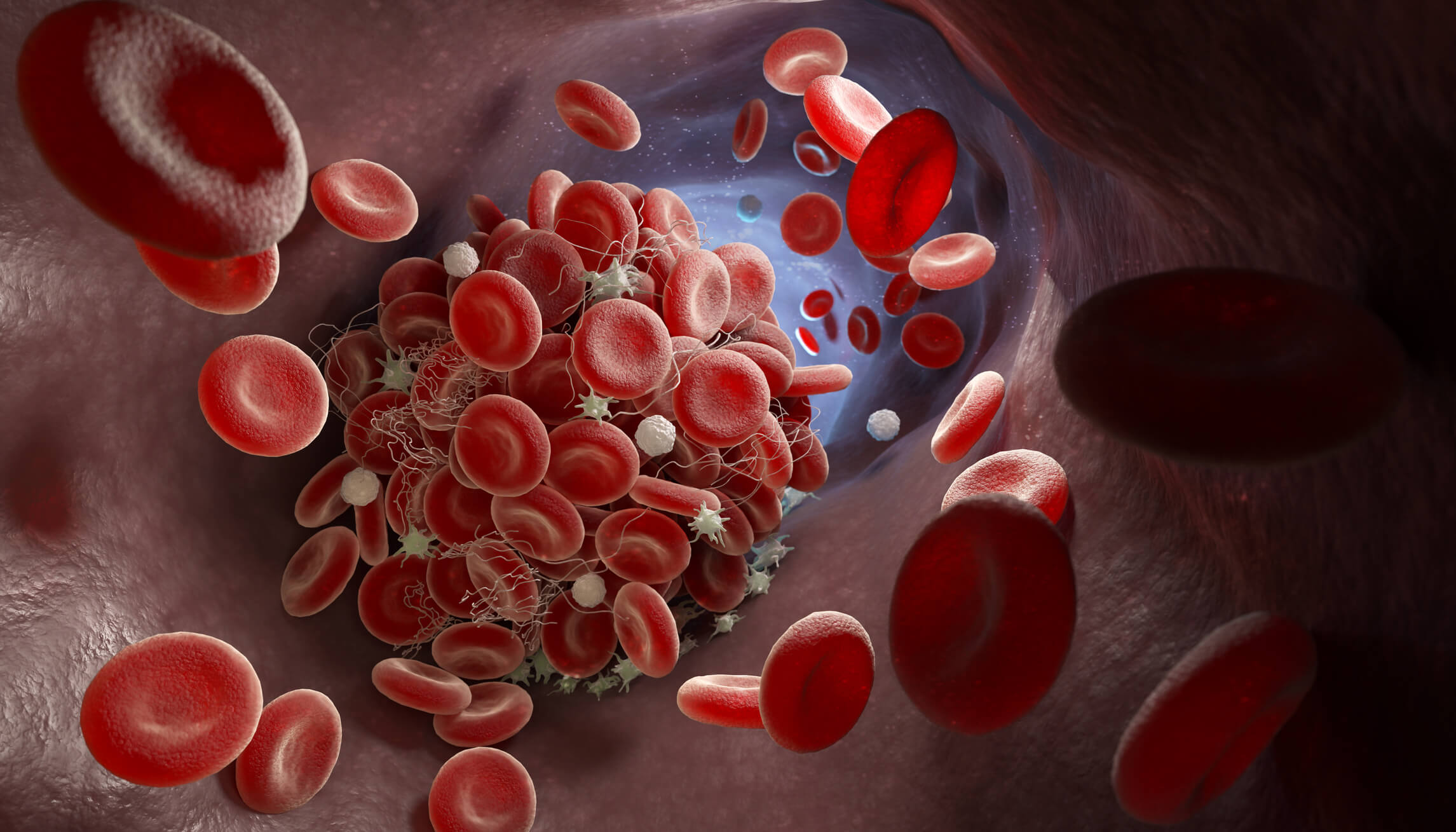 Du système immunitaire aux vaisseaux sanguins: comment limiter les thromboses lors d’infections sévères