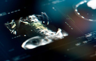 Détermination de la cinématique de la colonne lombaire à l'aide de l'imagerie par ultrasons